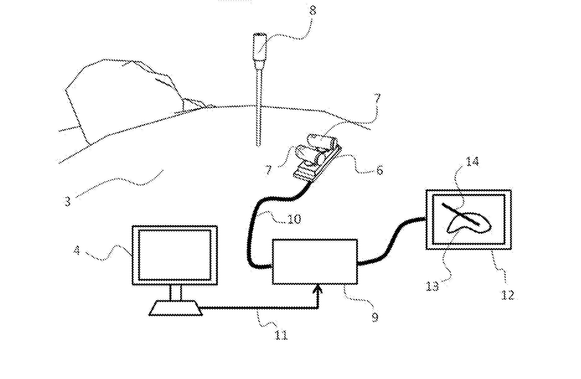 Device and method for determining the position of an instrument in relation to medical images