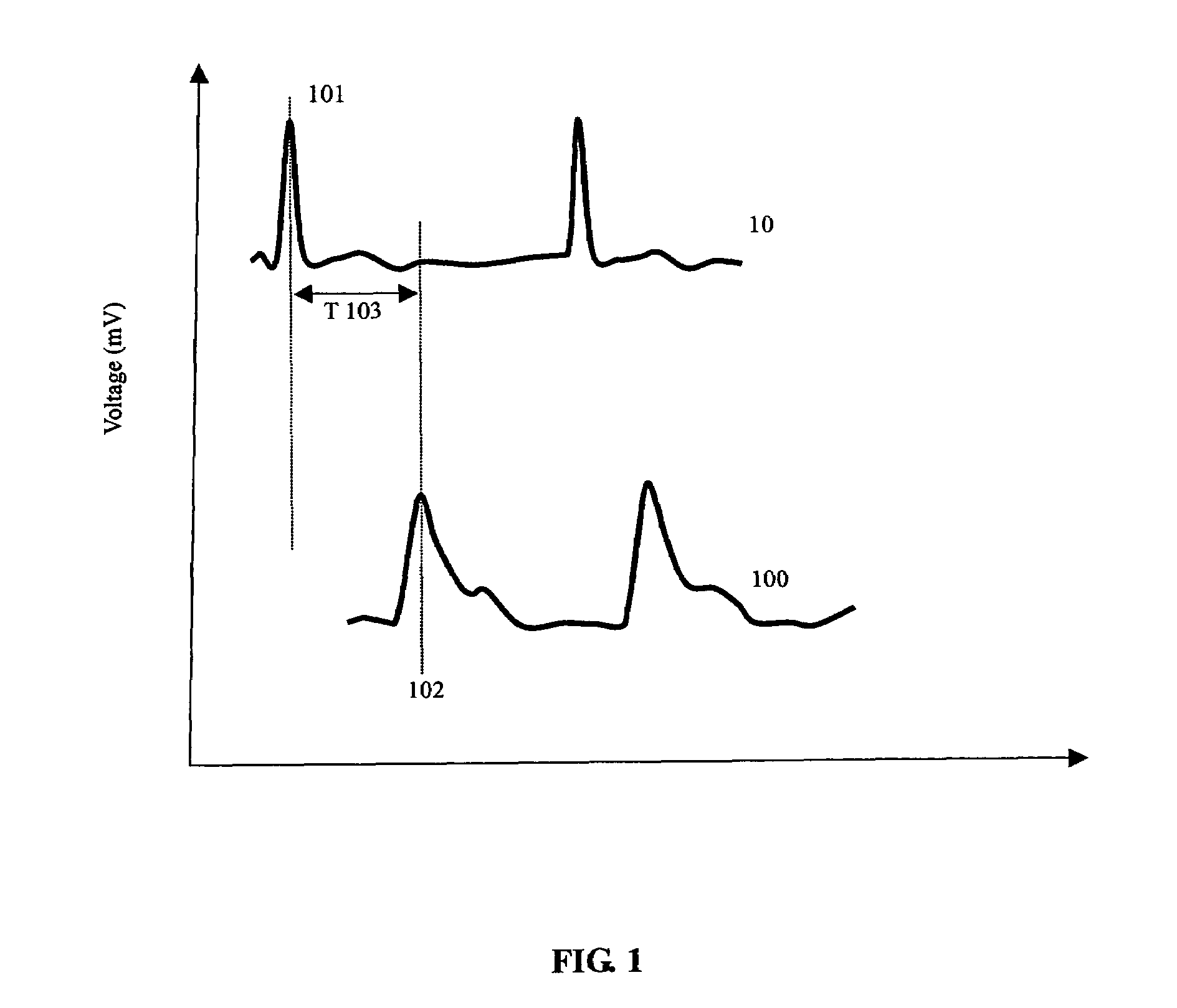 Methods for measuring blood pressure with automatic compensations