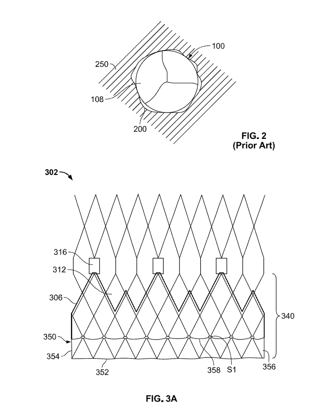 Prosthetic heart valve with paravalvular leak mitigation features