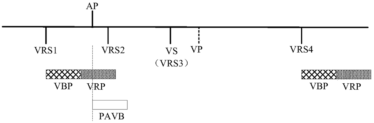 Method for Eliminating High-frequency Interference in Ventricular AV Interval of Implantable Cardiac Pacemaker