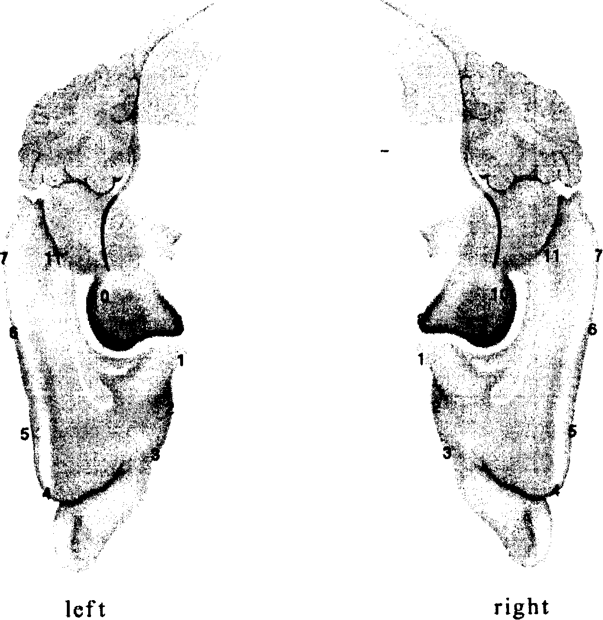 Clinical application of recognition rejection counteract caused by reflection original agitation subconscious memorization technology