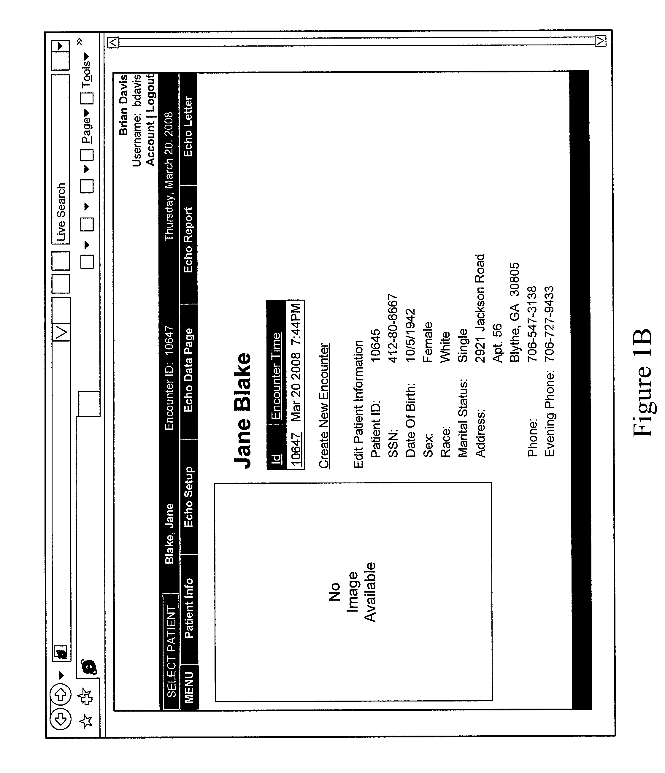 Creating a report having computer generated narrative text