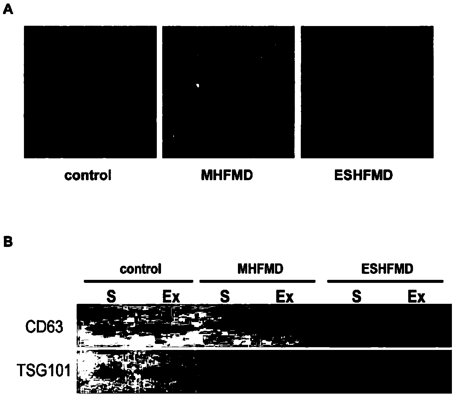 Molecular marker used for diagnosing extremely severe case of hand-foot-and-mouth disease and testing method as well as kit