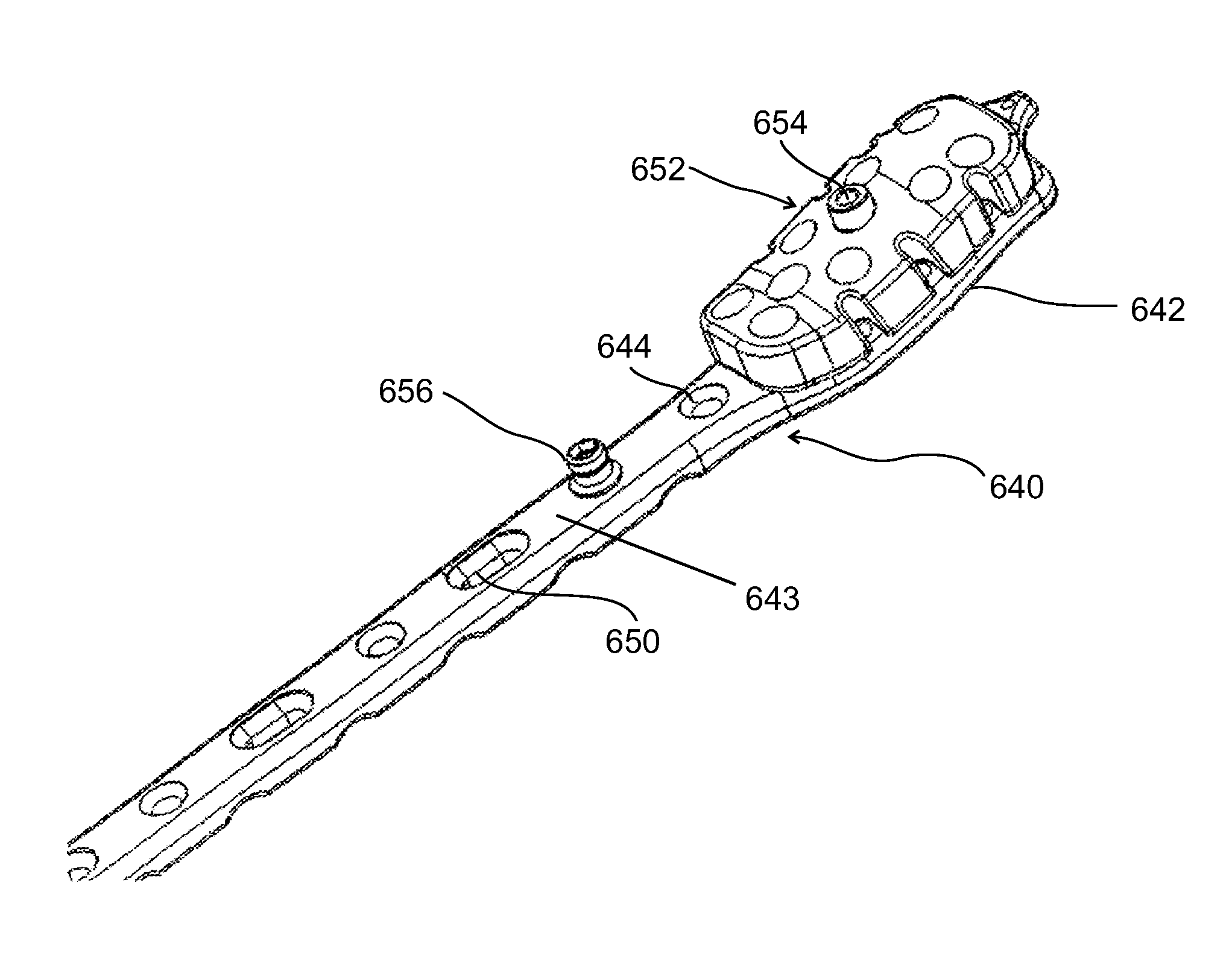 Composite material bone implant