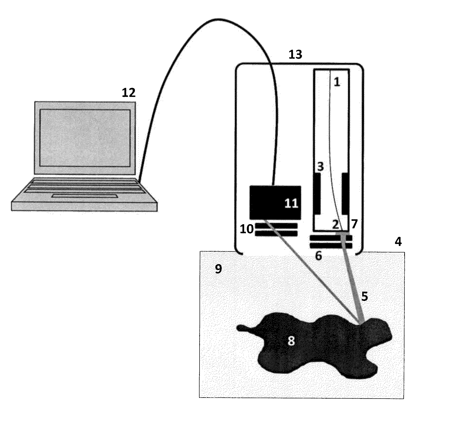 X-Ray Backscatter Imaging of an Object Embedded in a Highly Scattering Medium