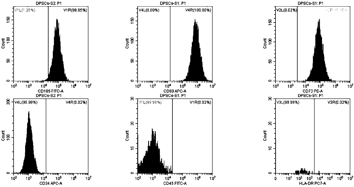 Method for inducing dental pulp stem cells (DPSCs) to be differentiated into cardiomyocyte-like cells