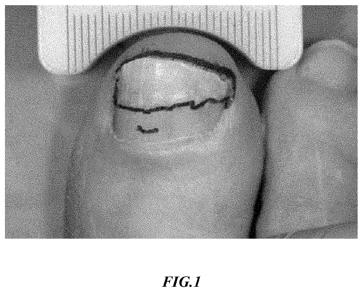 Onychomycosis Treatment Compositions and Methods