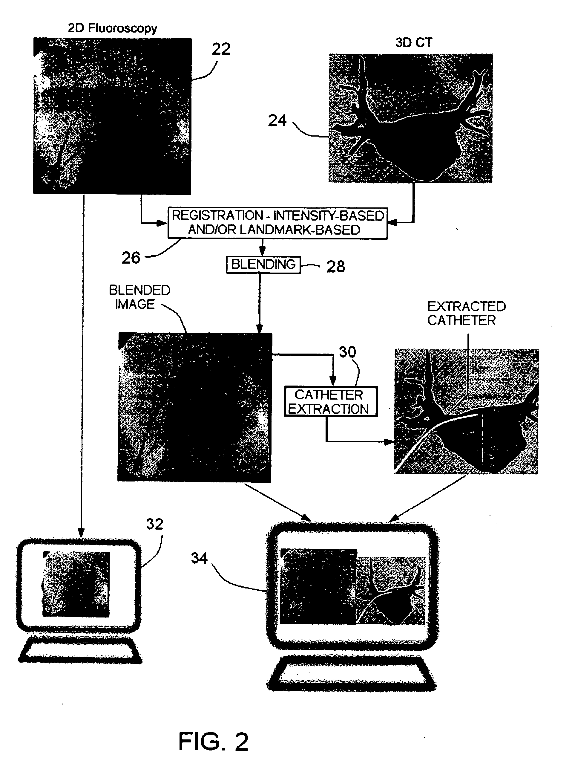 Method and system for cardiac imaging and catheter guidance for radio frequency (RF) ablation