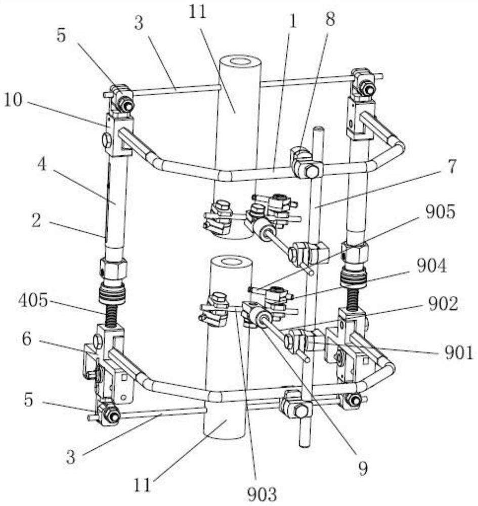 External fixation support for orthopedics department