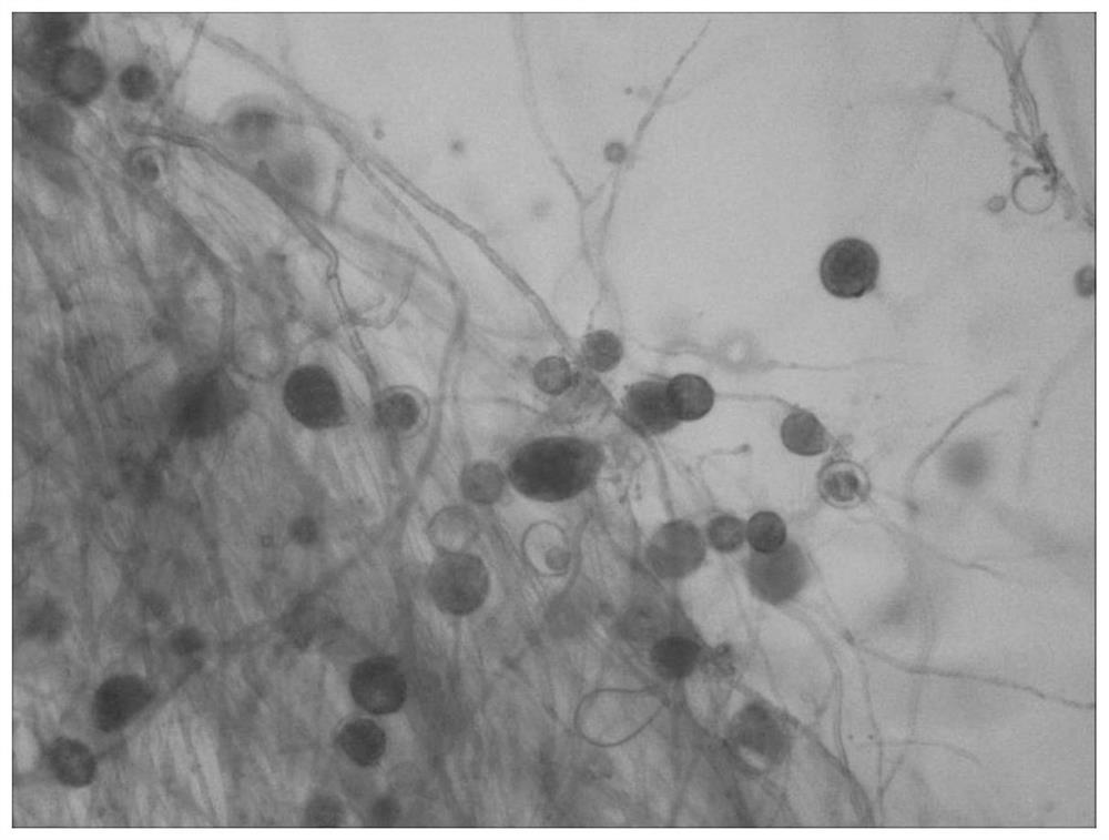 A culture medium for inducing spore production of Phytophthora capsici, preparation method and application