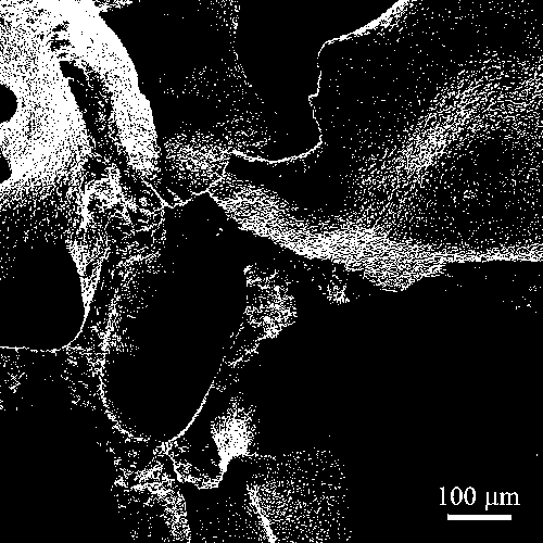 Injectable porous bone cement and preparation method thereof