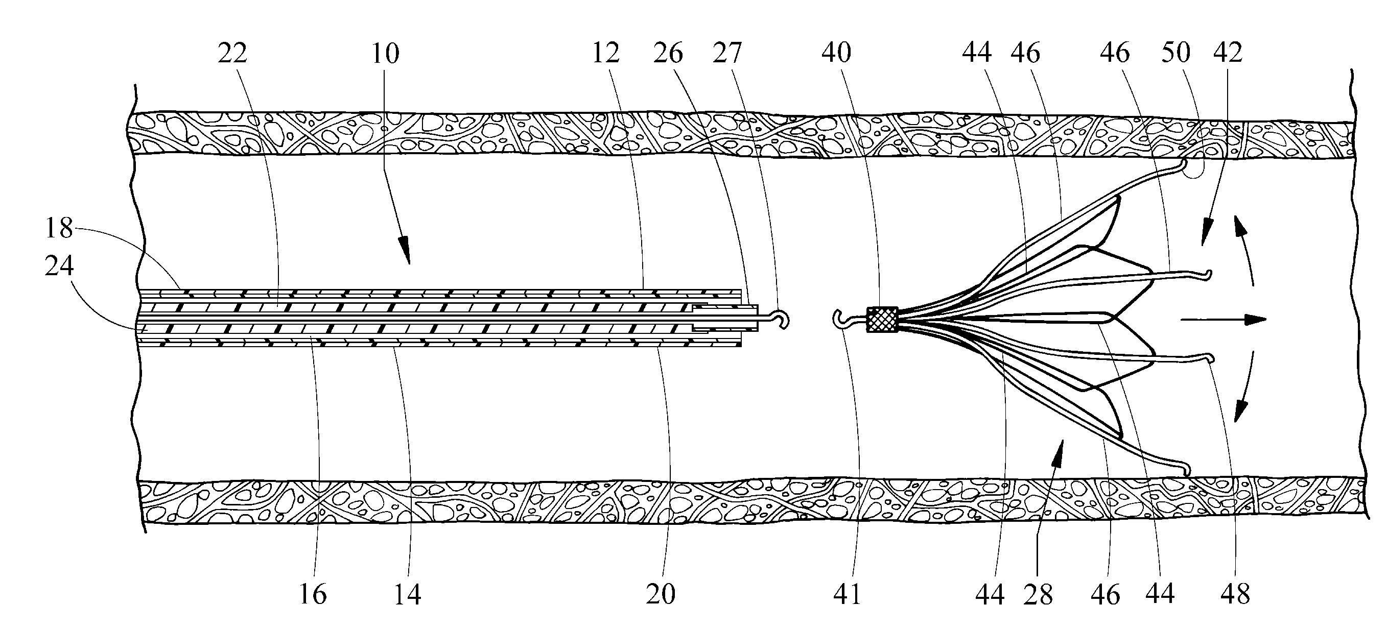 Puncture and abrasion resistant sheath