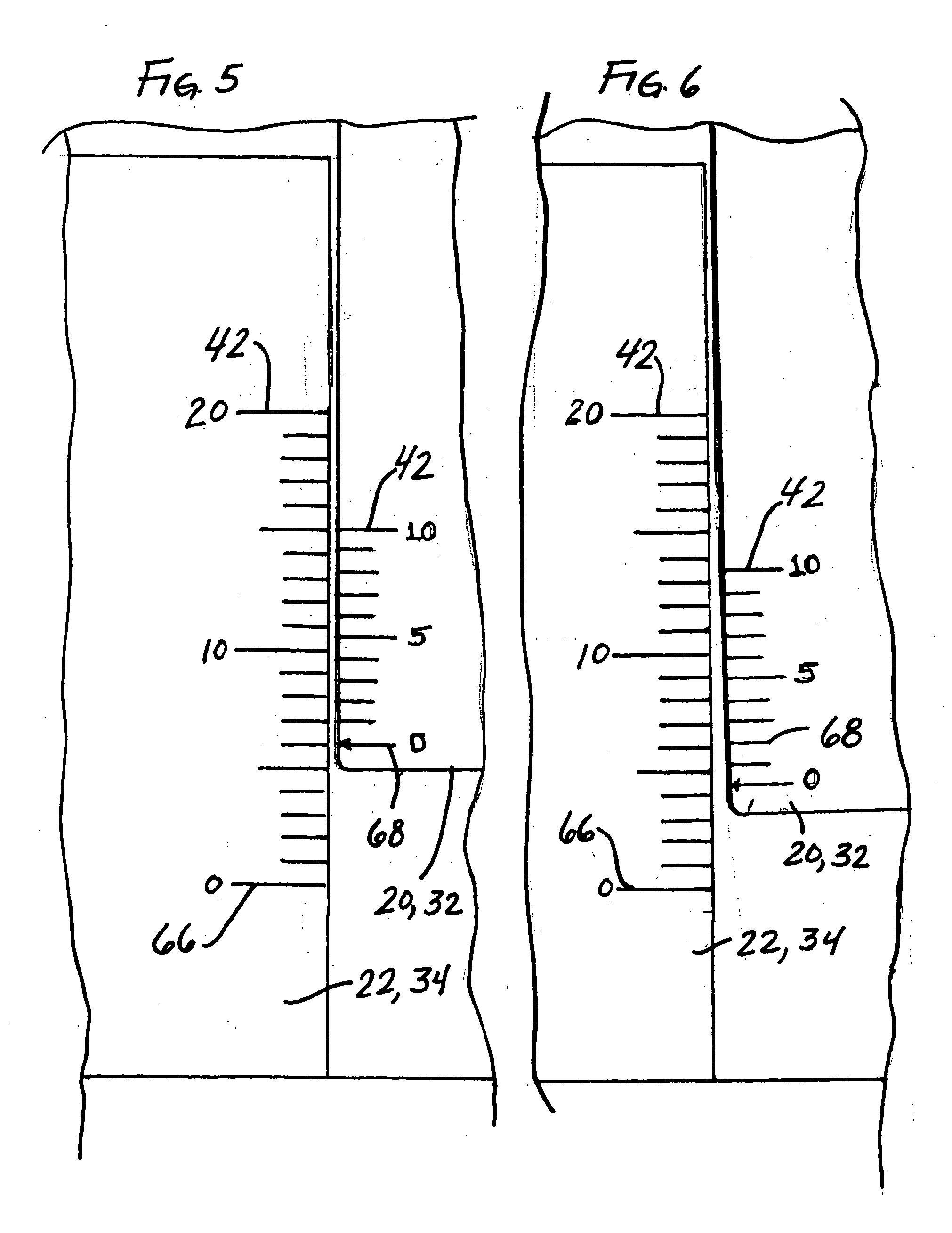 Implant system with migration measurement capacity