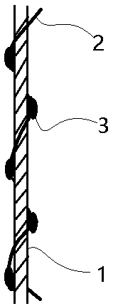 Surgical suture line of winding structure