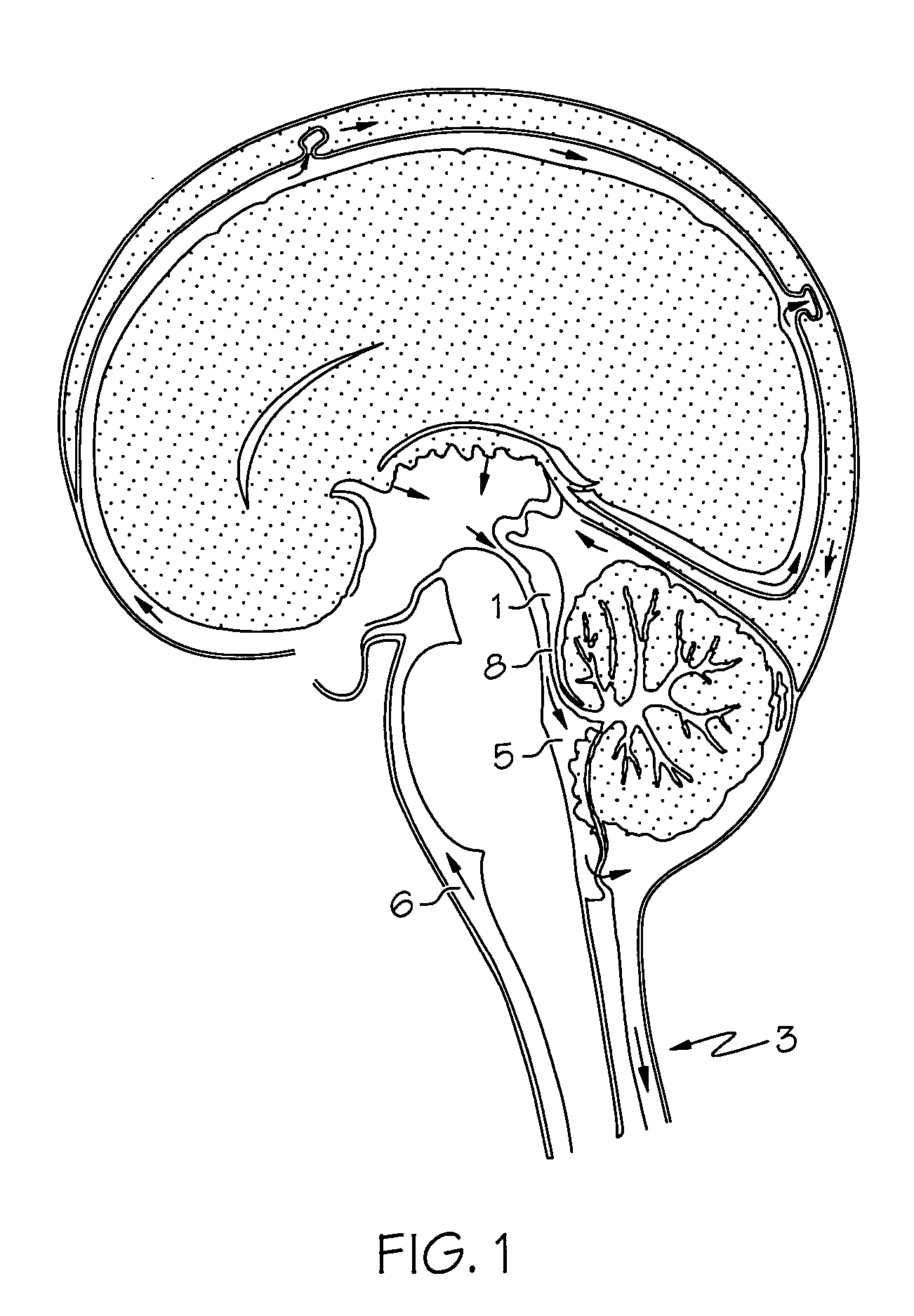 Intrathecal gabapentin for treatment of epilepsy