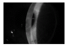 Corneal surface protectant as well as preparation method and application thereof