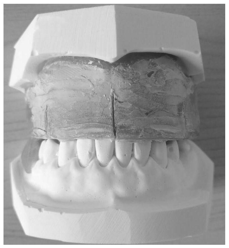 CAD/CAM digital manufacturing method of frame movable denture