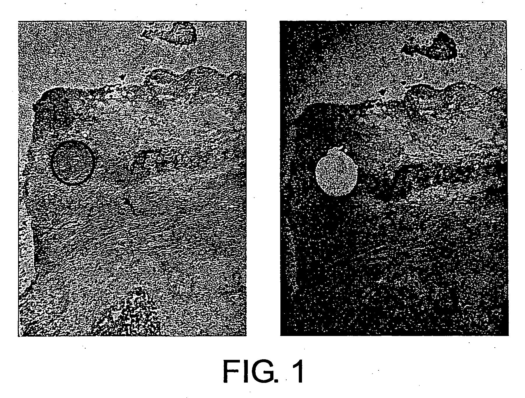 Antibodies against lesion tissue