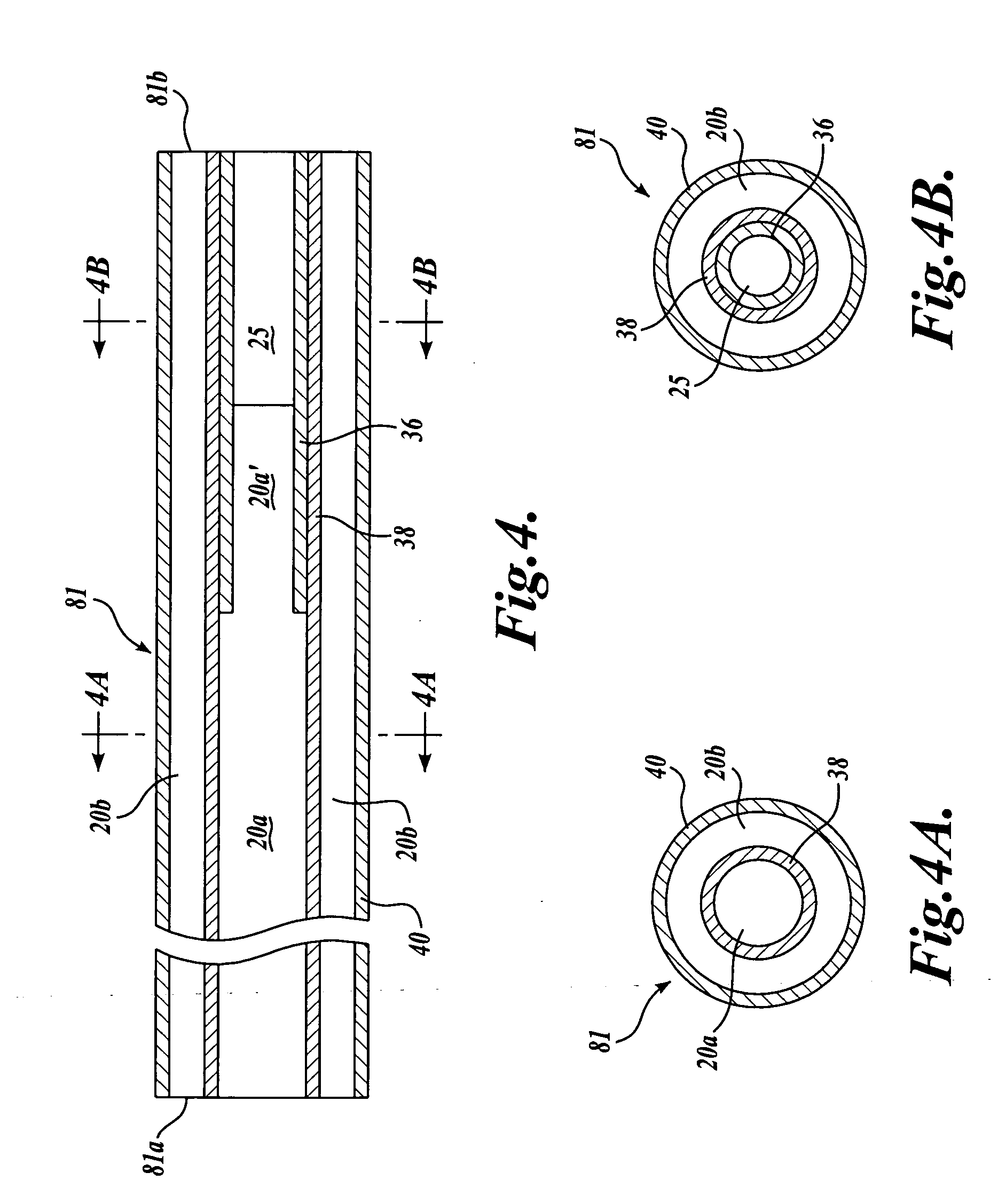 Stent delivery system with imaging capability