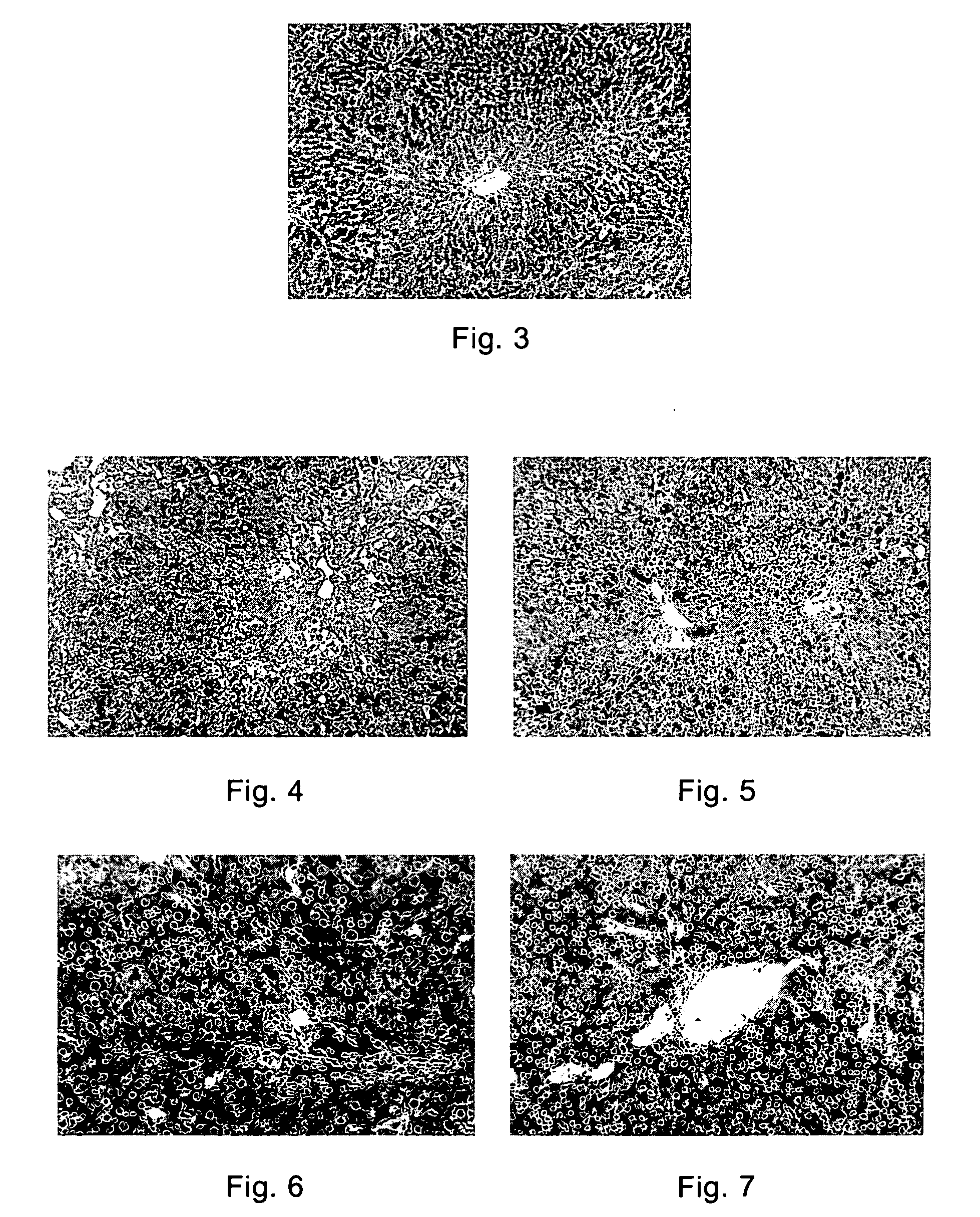 Derivatives of pyridone and the use of them