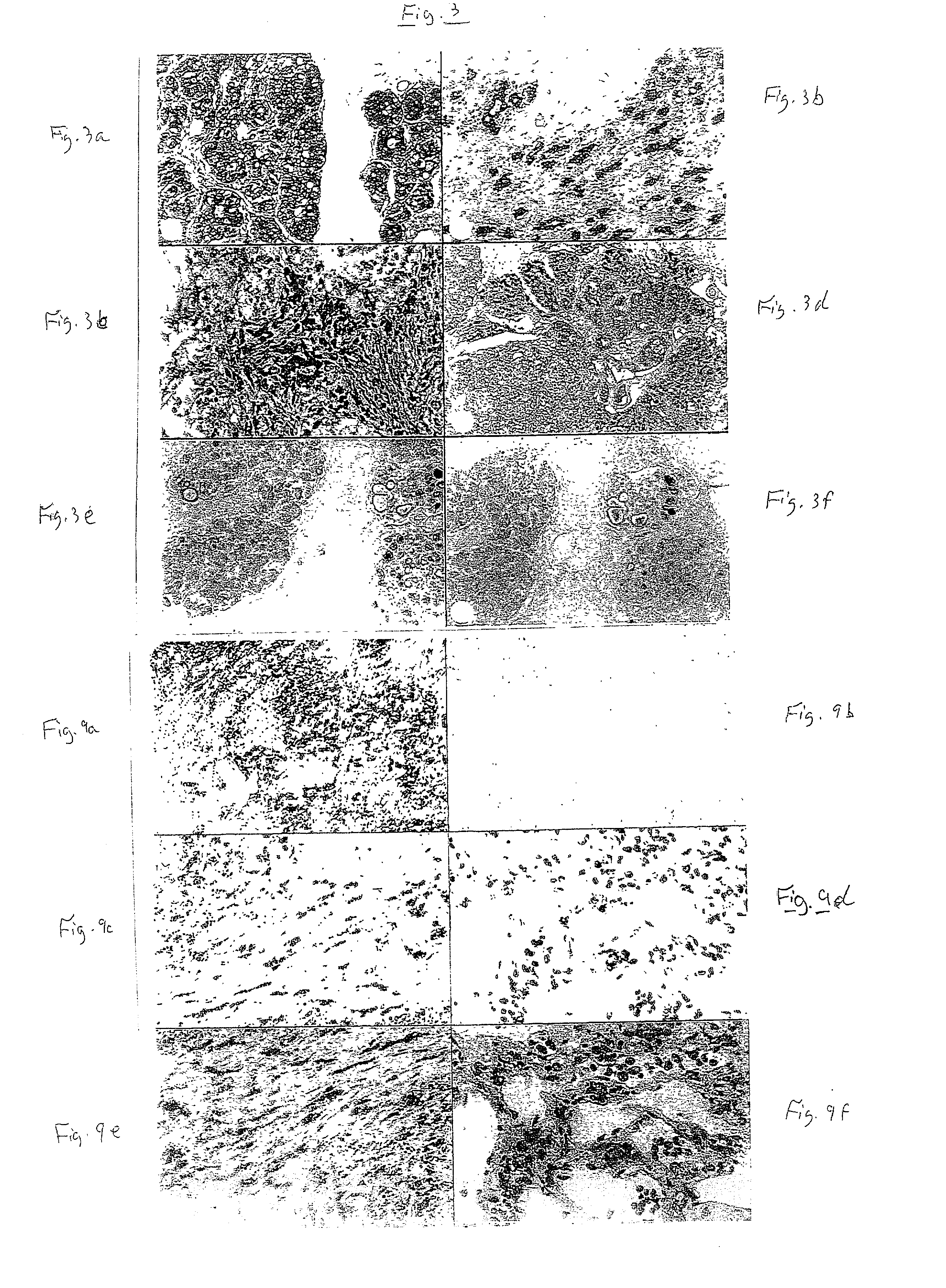 Heparanase specific molecular probes and their use in research and medical applications