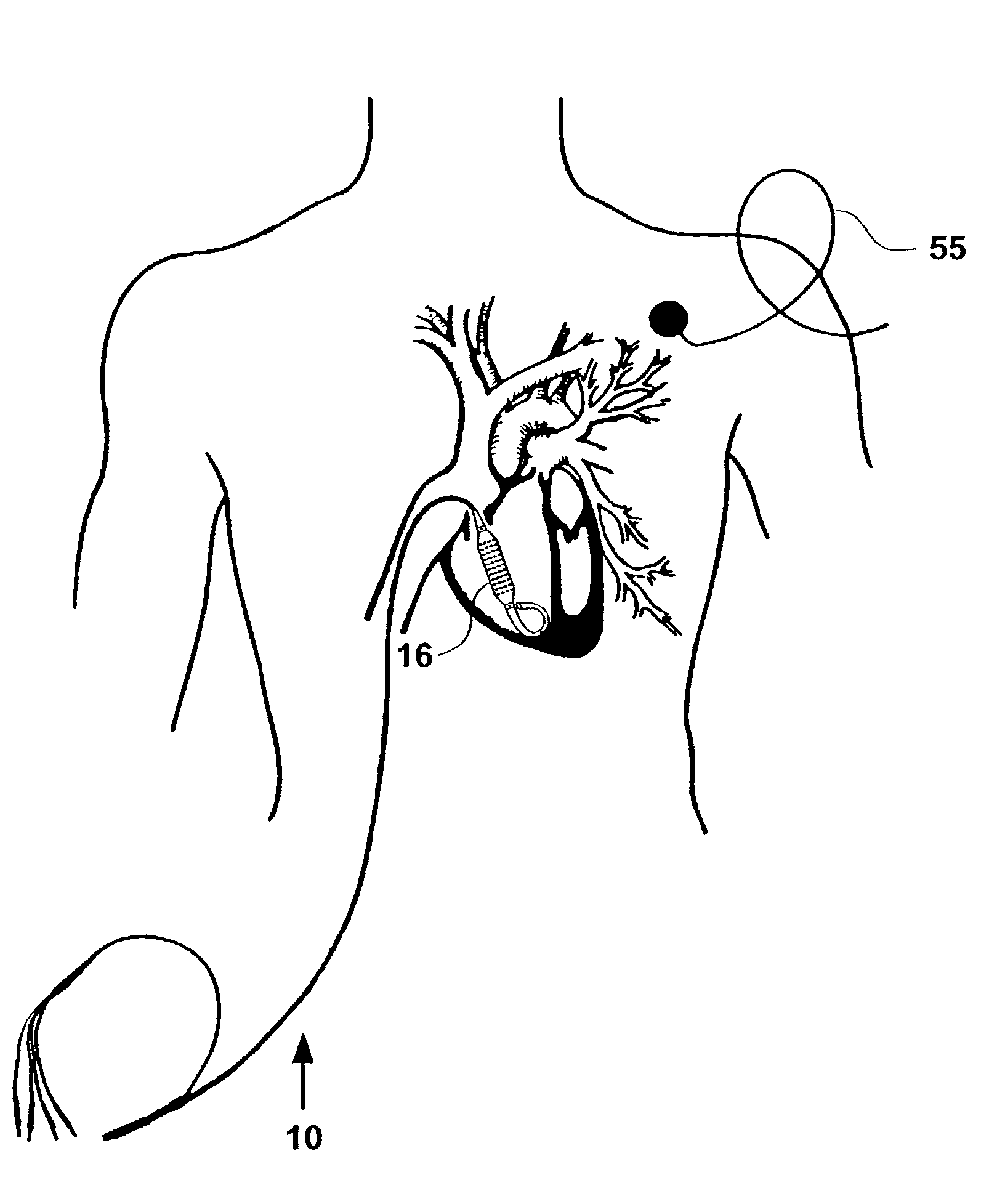 Cardiac catheter imaging system