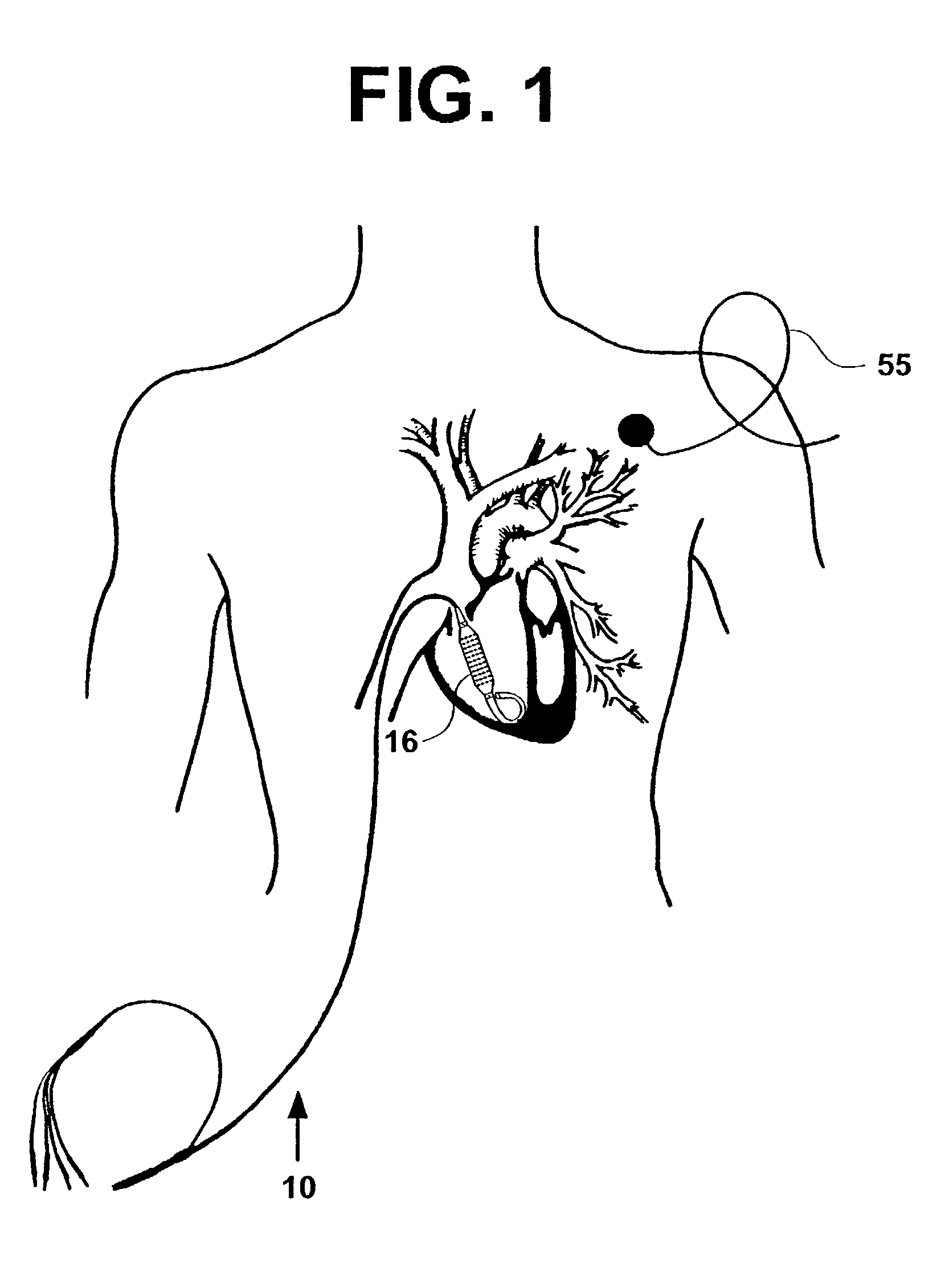 Cardiac catheter imaging system