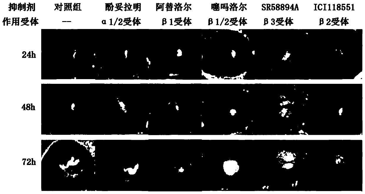 Drug for relieving pseudomonas aeruginosa keratitis