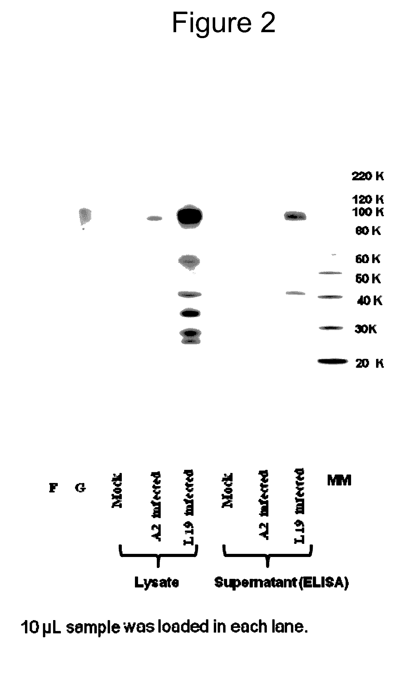 Human respiratory syncytial virus vaccine