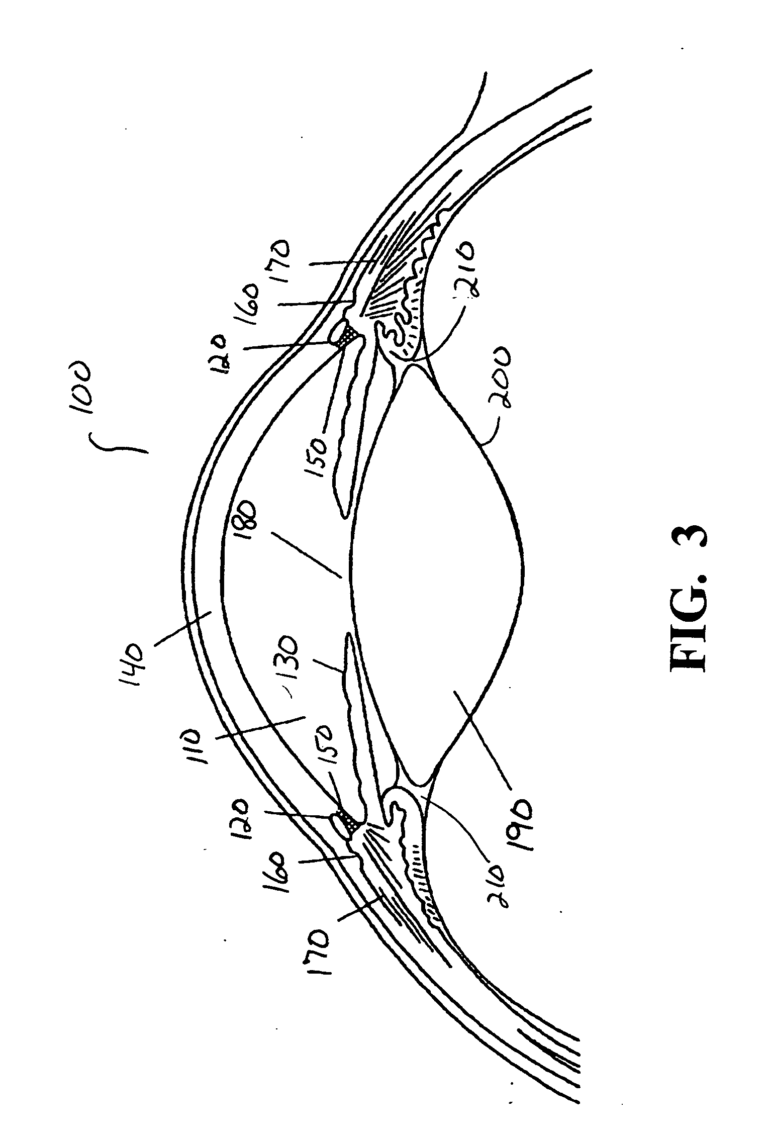 Surgical apparatus