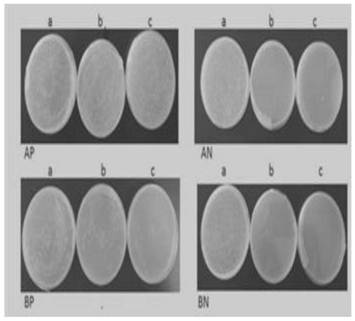 Yeast cDNA library and construction method of a sheep testis fibroblast membrane system