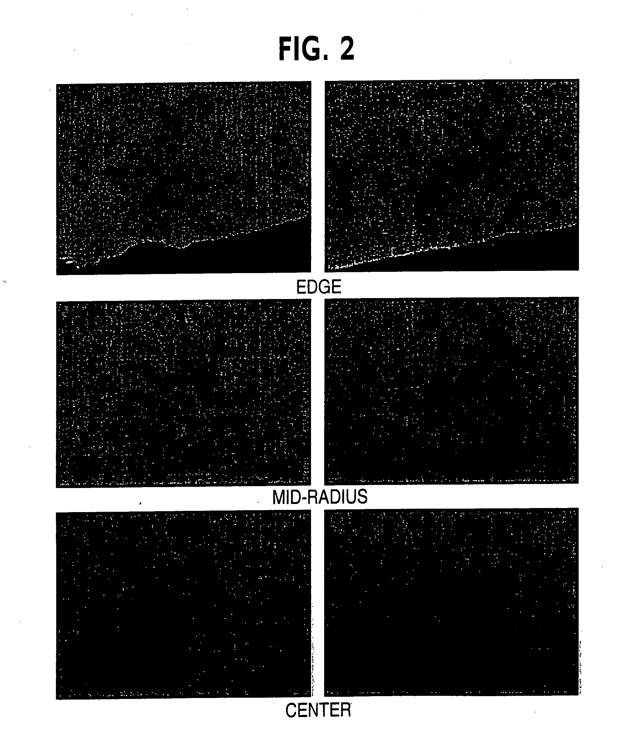 Semi-solid metal casting process of hypoeutectic aluminum alloys