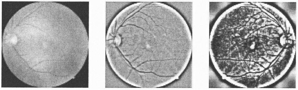 Detection method for eyeground multi-disease classification based on deep learning