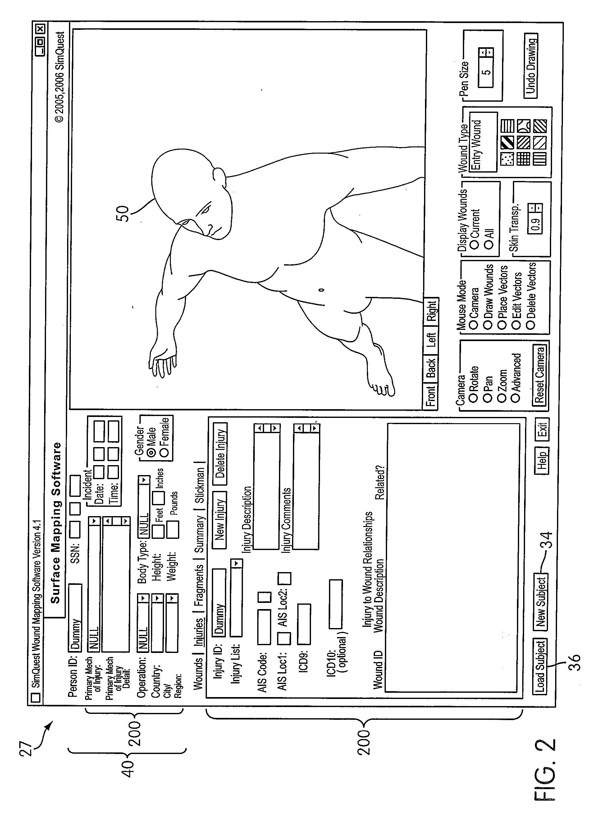 Method and apparatus for collecting and analyzing surface wound data