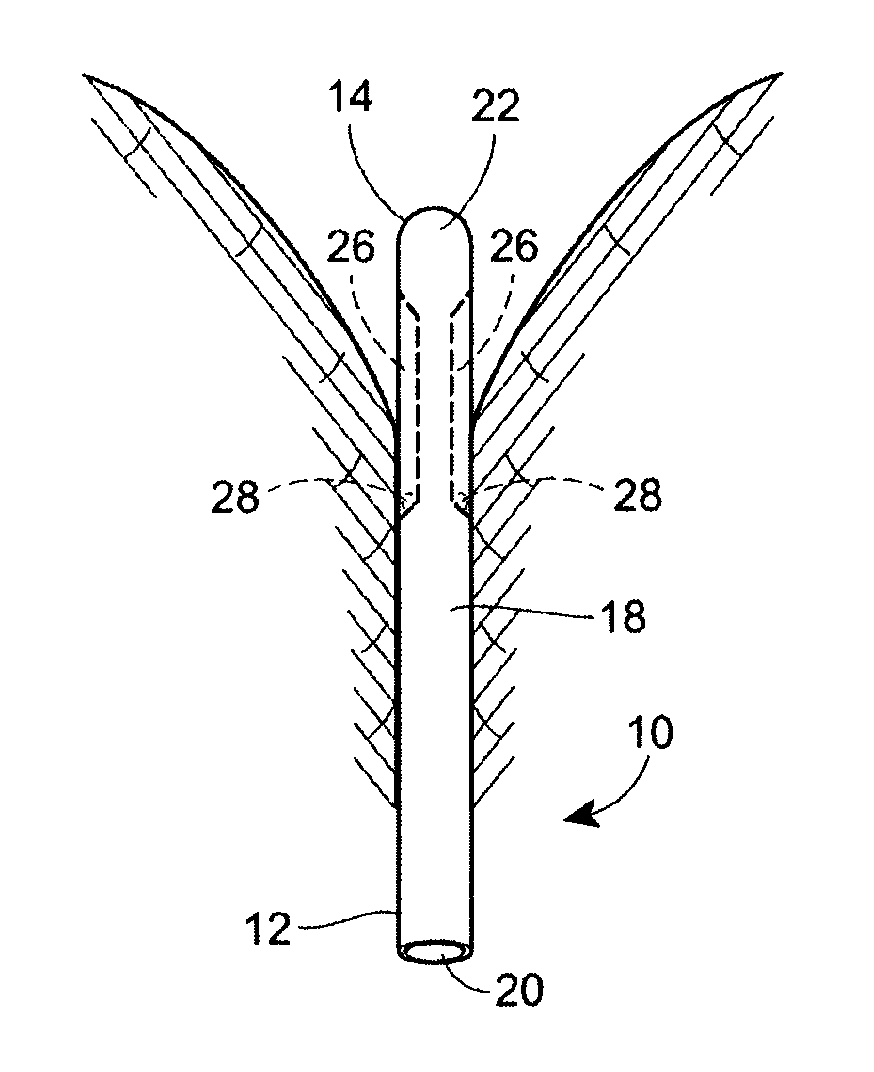 Fluid drainage catheter having an external flow path