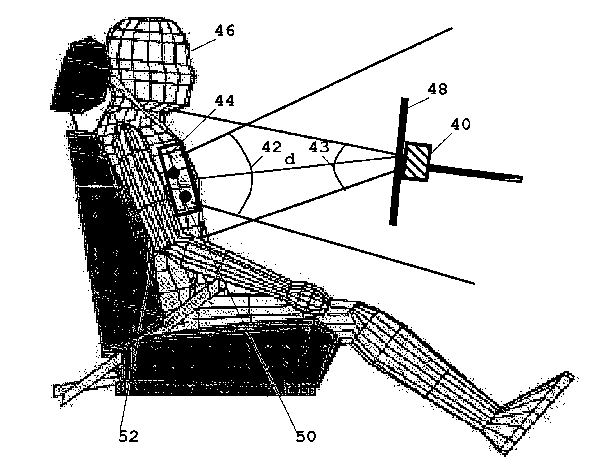 Radar-assisted sensing of the position and/or movement of the body or inside the body of living beings