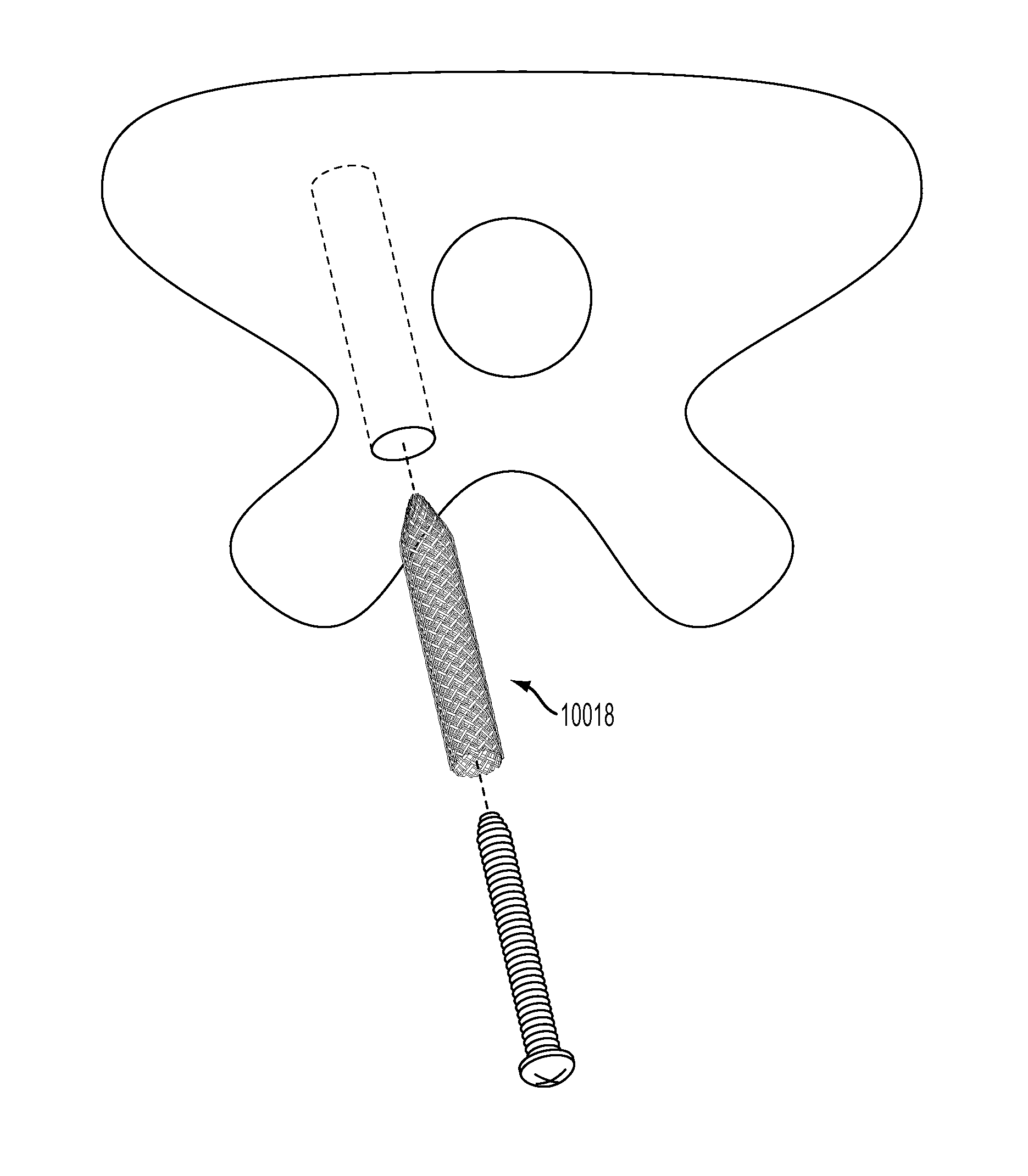 Woven retention devices, systems and methods