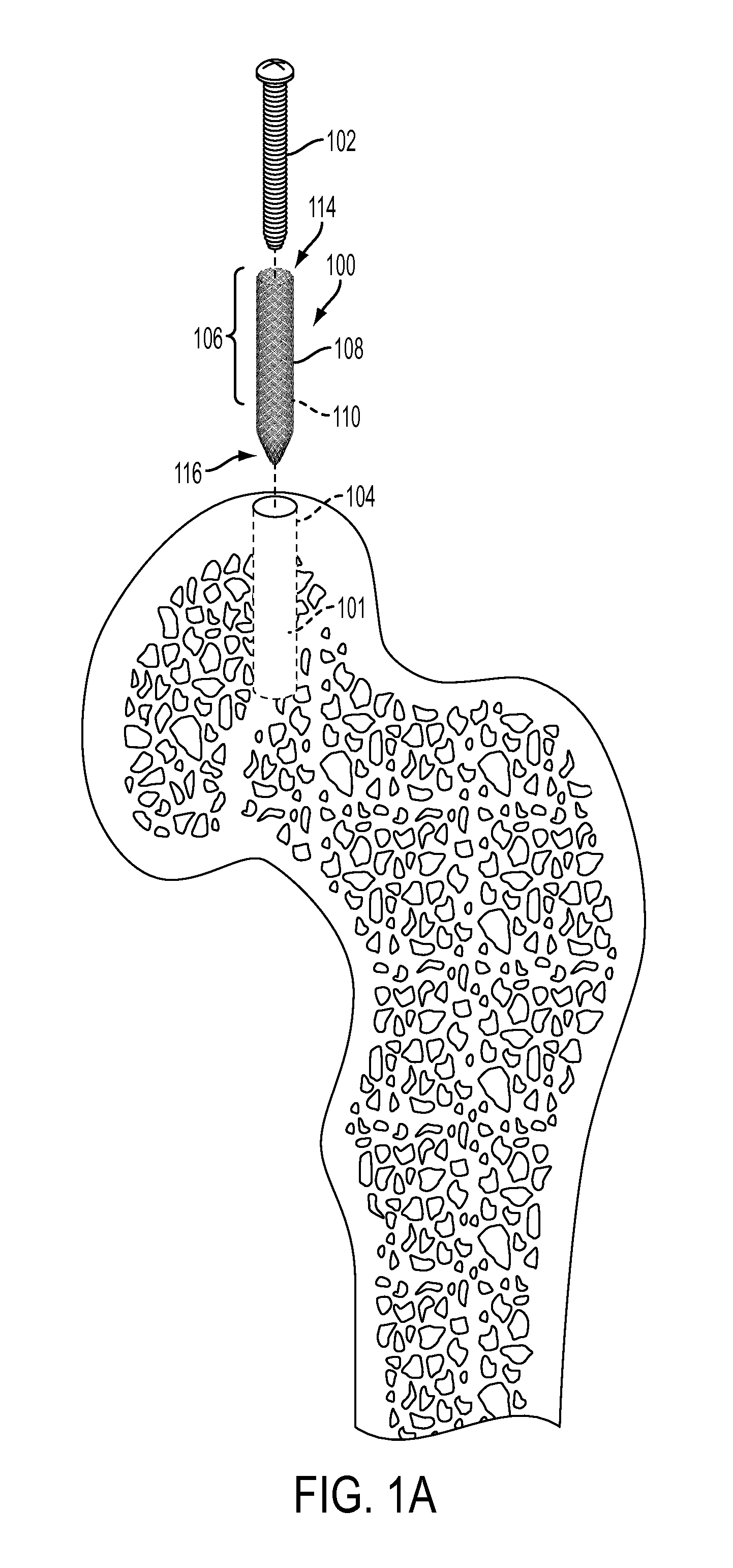 Woven retention devices, systems and methods