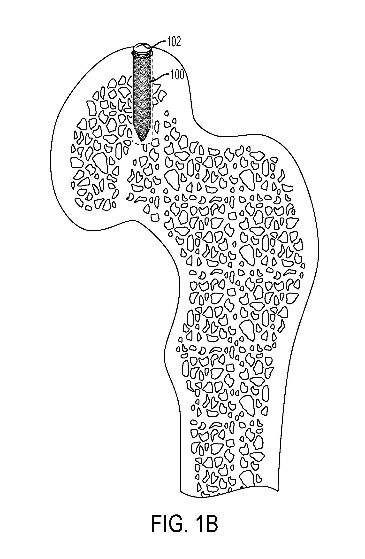 Woven retention devices, systems and methods