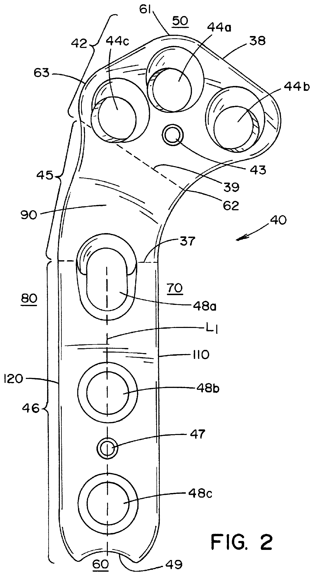 Tibial fixation plate