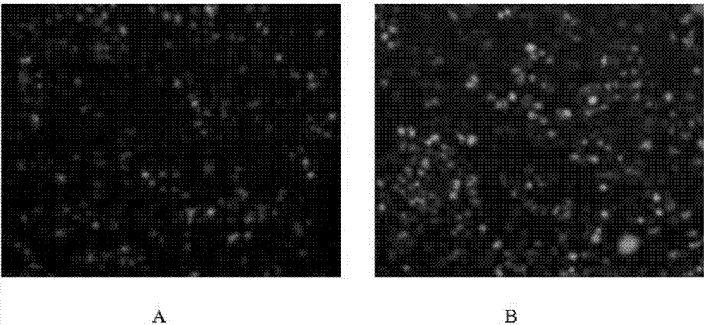 Targeted anti-cSCC (cutaneous squamous cell carcinoma) co-carrying super deformation liposome as well as preparation method and application thereof