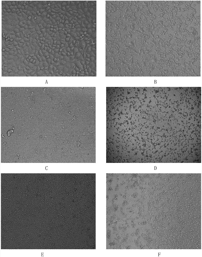 Application of chicoric acid in preparing drug for preventing respiratory syncytial virus