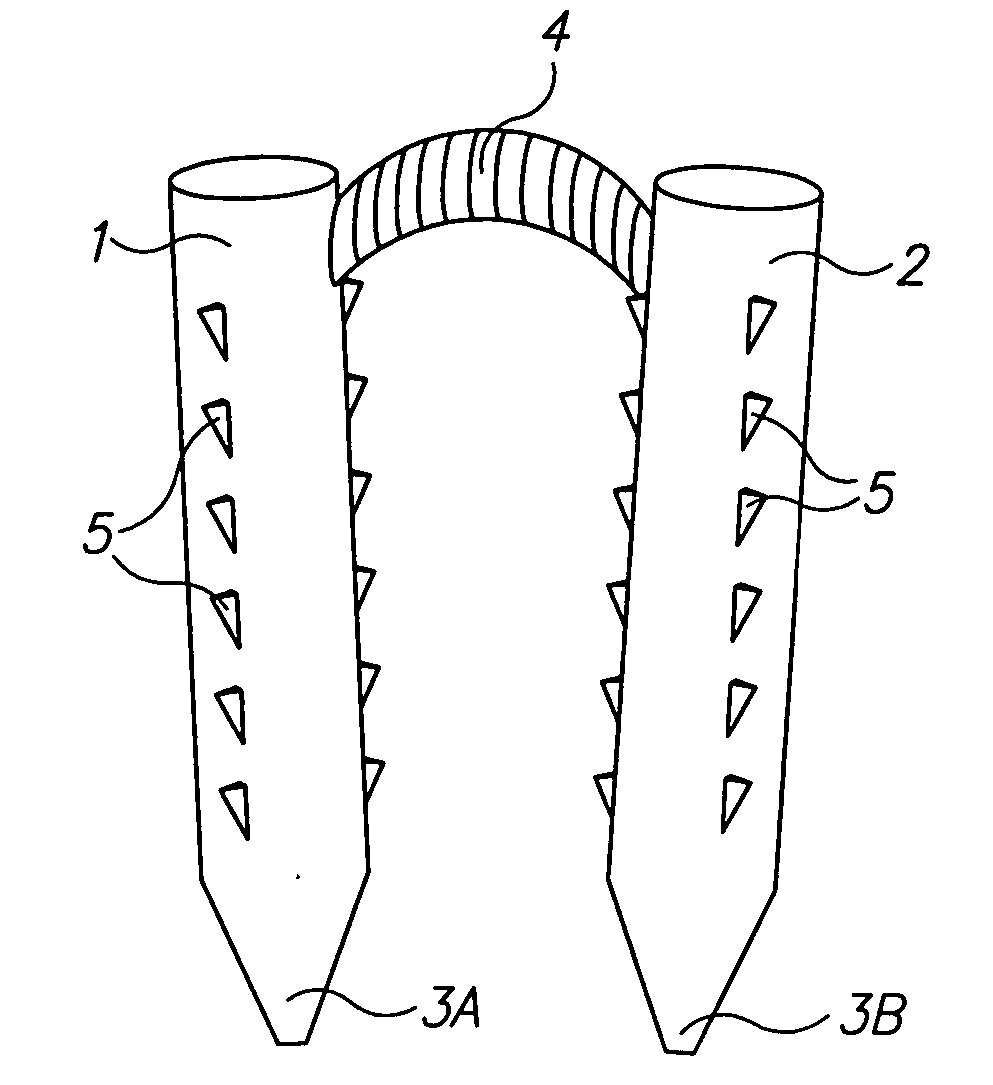 Surgical staples and methods of use thereof