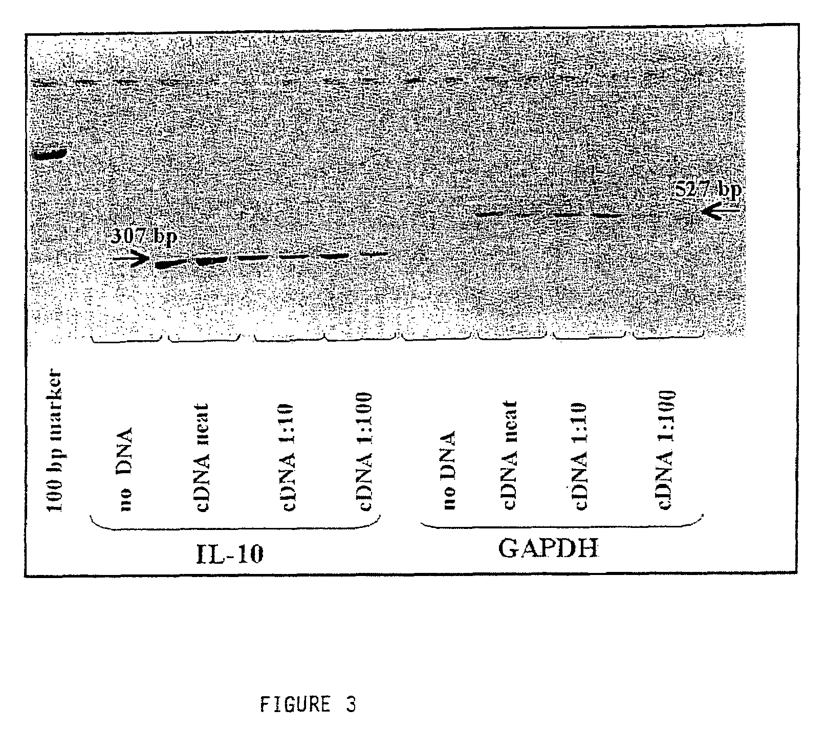 Corneal cells expressing active agents and methods of use thereof