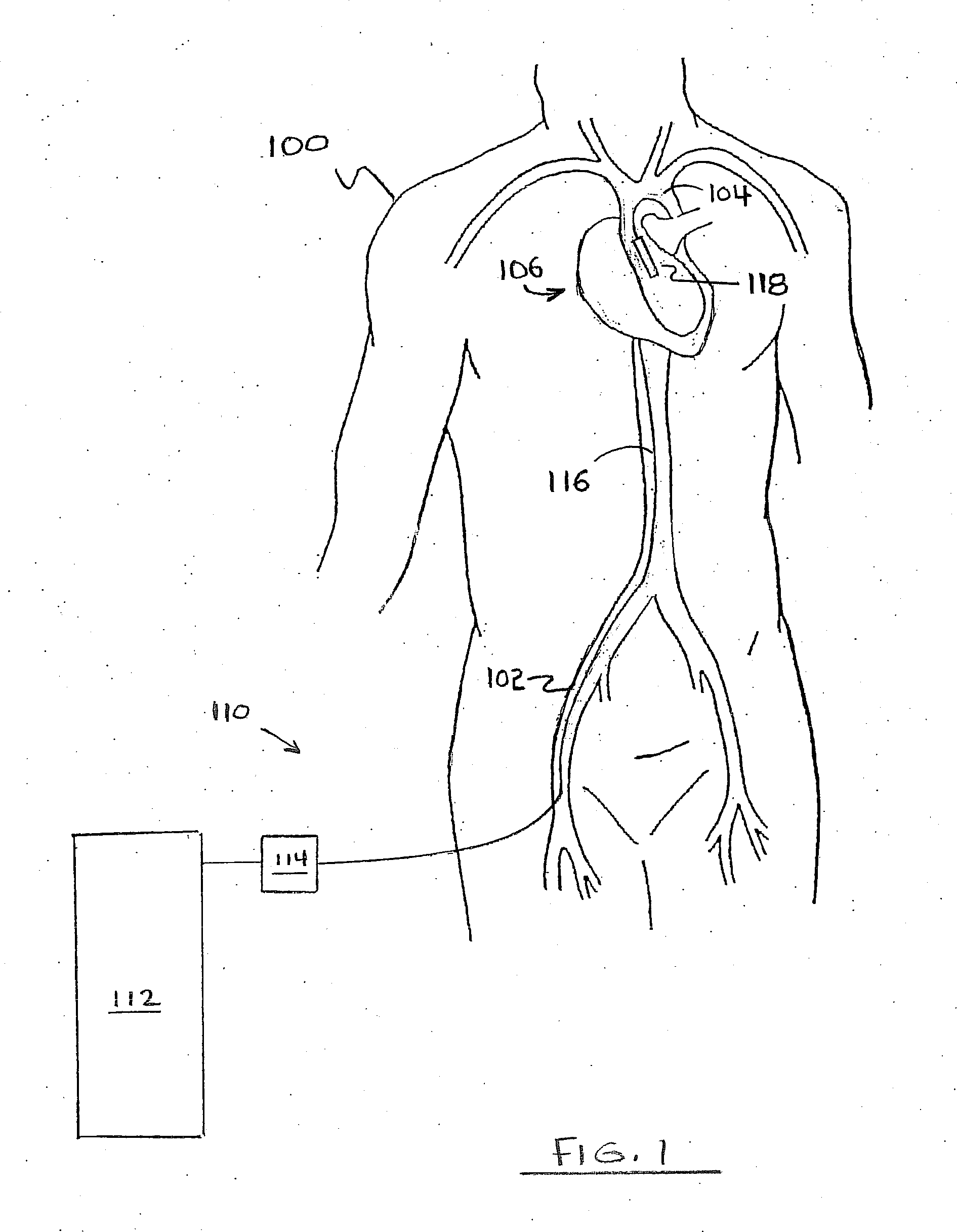 Method for Deployment of a Medical Device