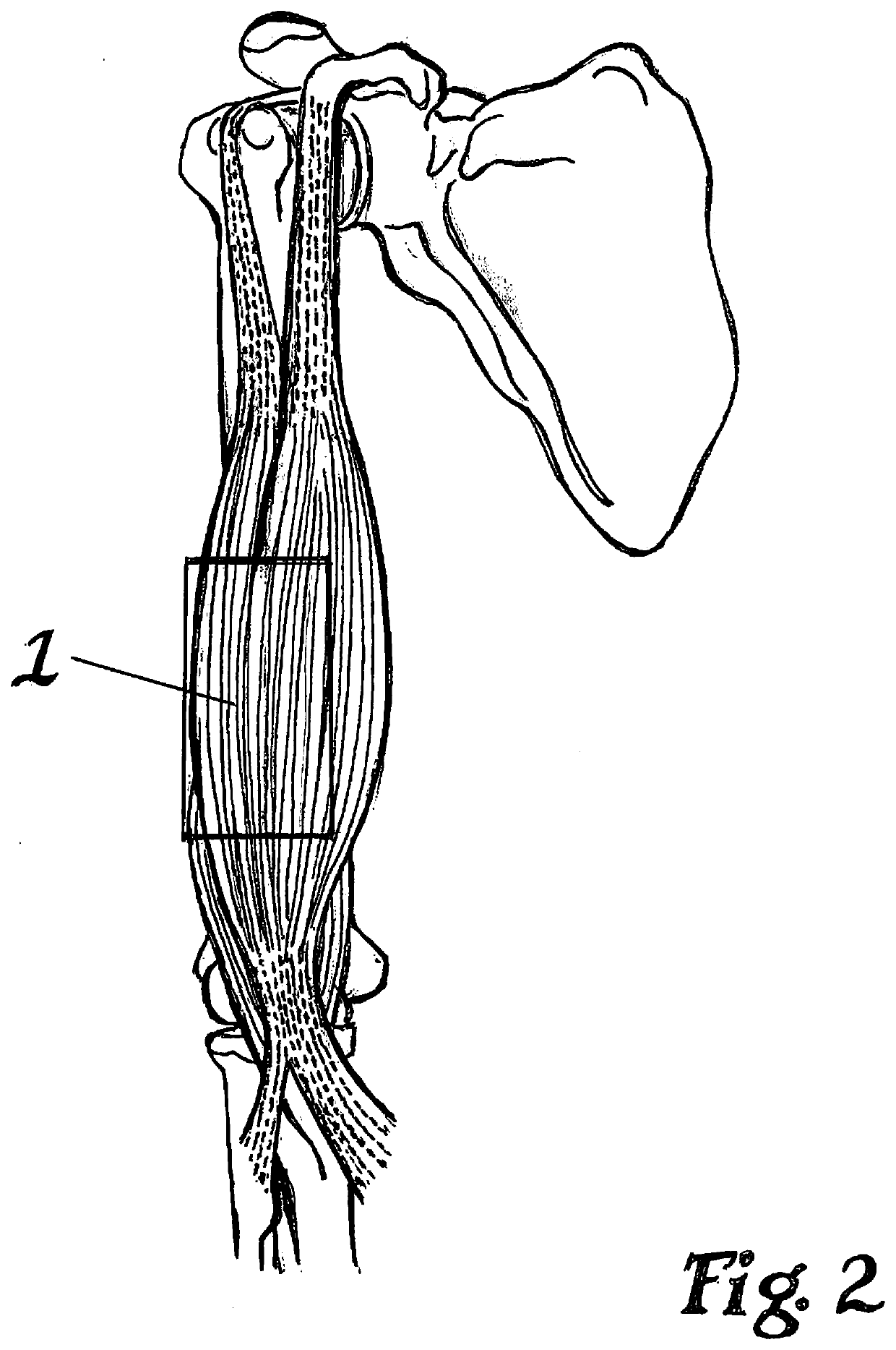 Taping Method for Elicitation of Skeleton Muscle Tone