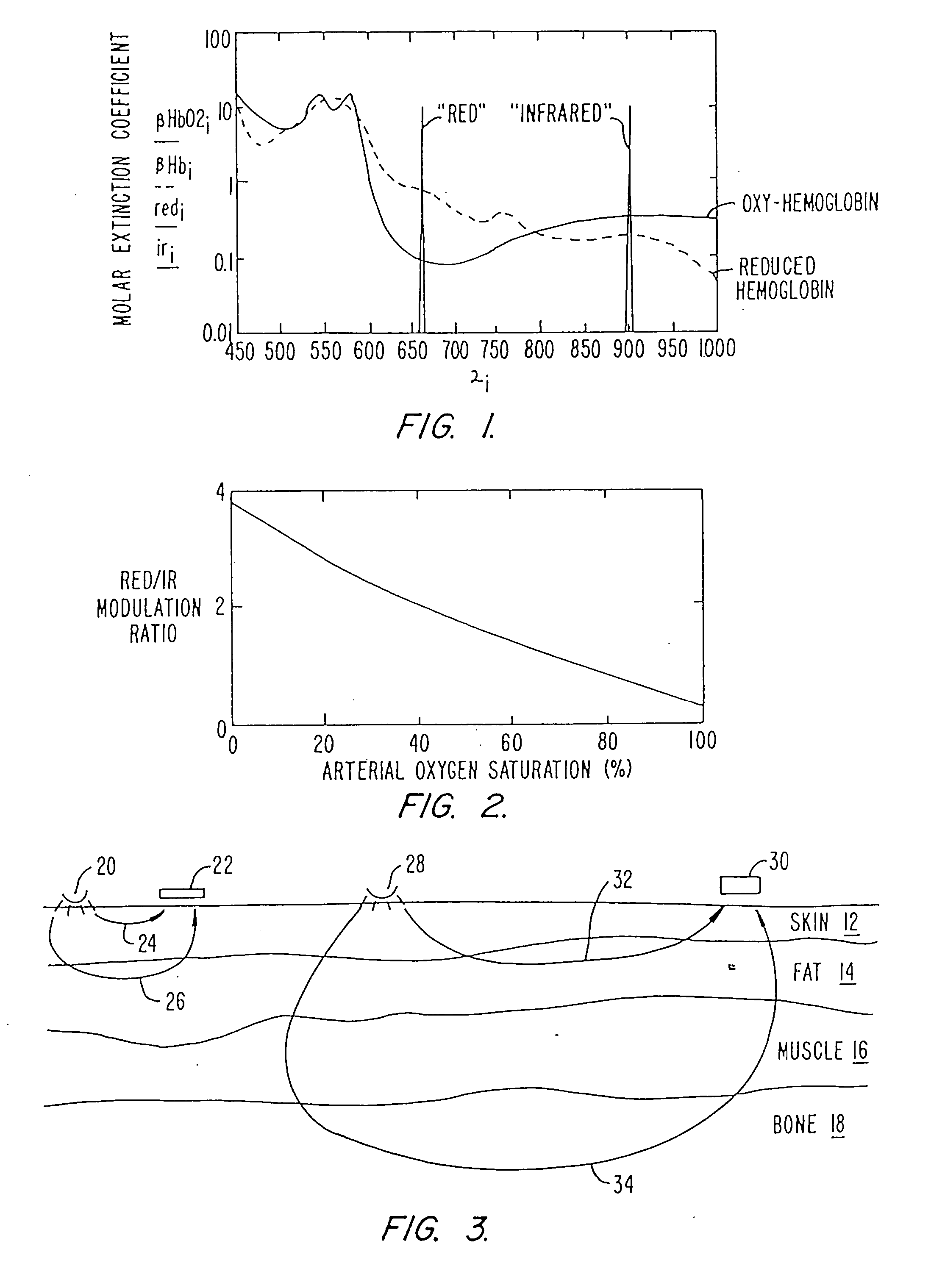 Pulse oximeter and sensor optimized for low saturation