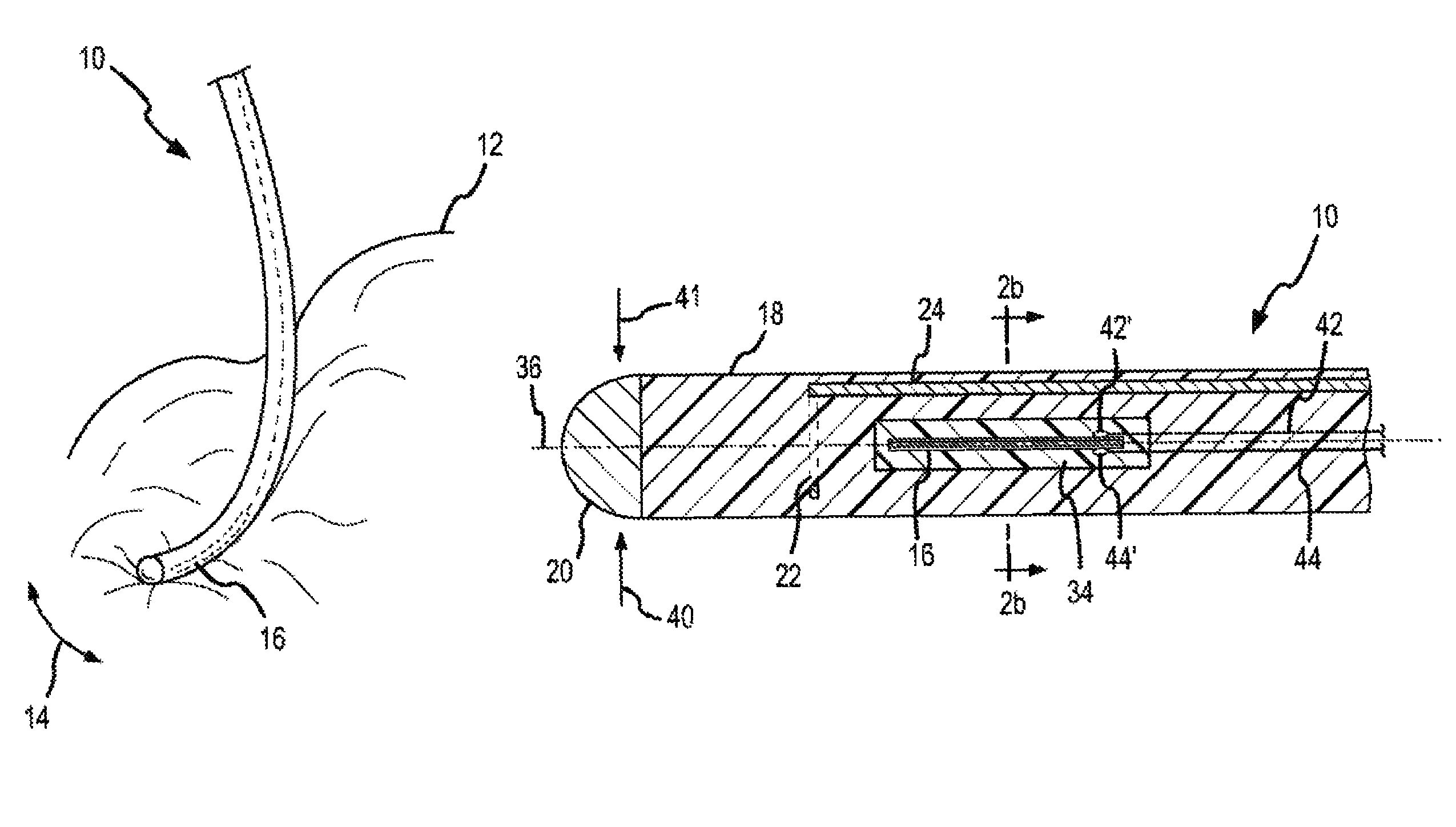 Dynamic contact assessment for electrode catheters