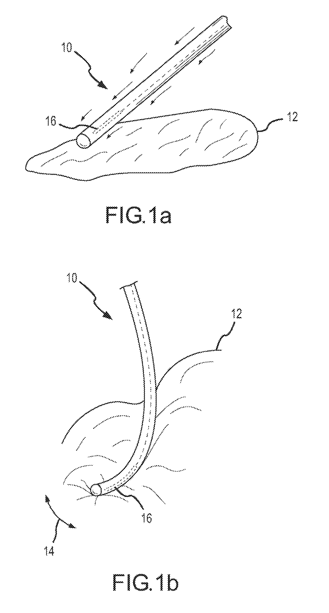 Dynamic contact assessment for electrode catheters