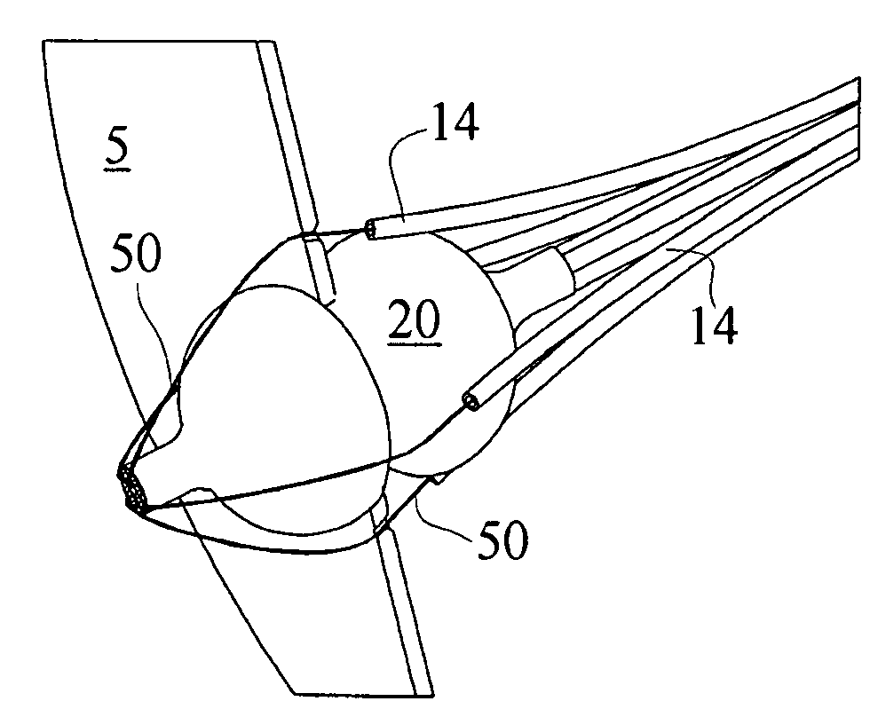 Noninvasive trans-catheter method and apparatus for remote suture placement such as for septal defect repair, left atrial appendage closure, pacemaker electrode placement, mitral valve repair, and other inner-cardiac and inner-arterial applications